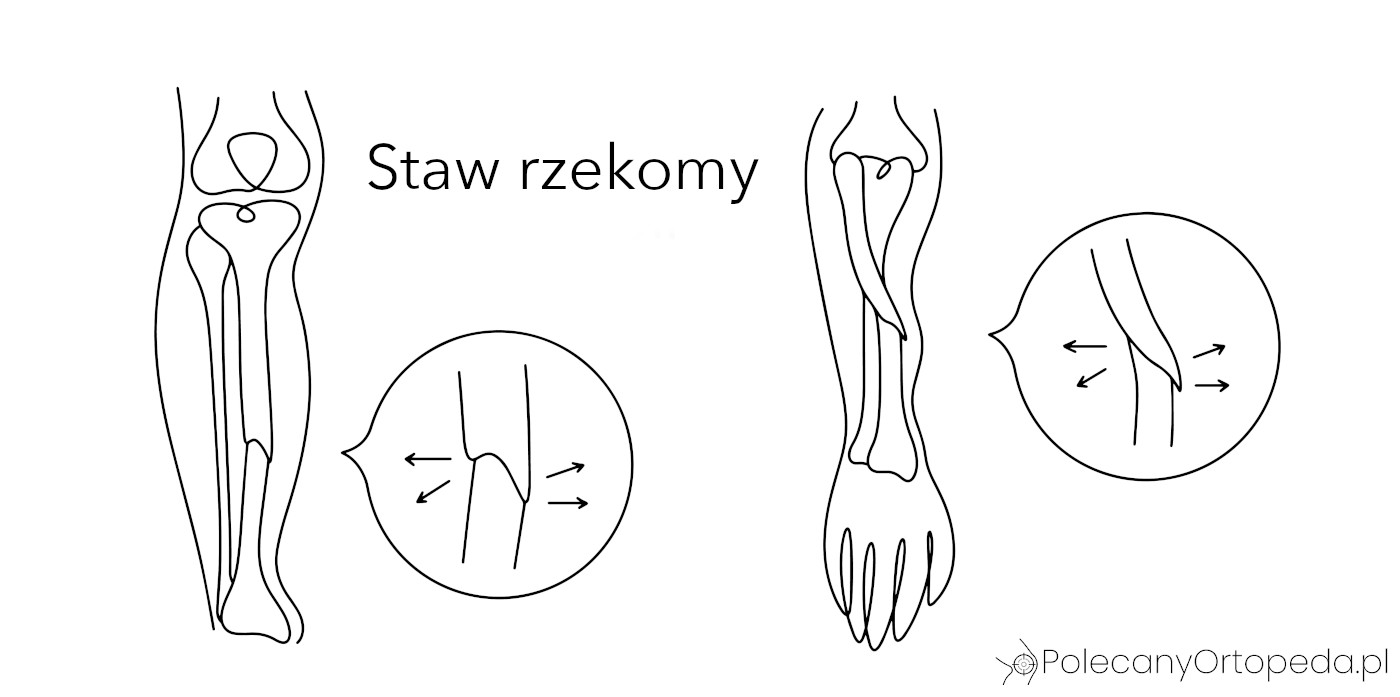 Staw rzekomy grafika ręka kość promieniowa łokciowa